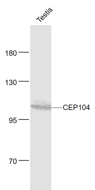Lane 1: Mouse Testis lysates probed with CEP104 Polyclonal Antibody, Unconjugated (bs-12005R) at 1:1000 dilution and 4˚C overnight incubation. Followed by conjugated secondary antibody incubation at 1:20000 for 60 min at 37˚C.