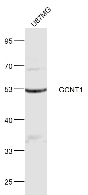 Lane 1: U87MG cell lysates probed with GCNT1 Polyclonal Antibody, Unconjugated (bs-12334R) at 1:1000 dilution and 4˚C overnight incubation. Followed by conjugated secondary antibody incubation at 1:20000 for 60 min at 37˚C.