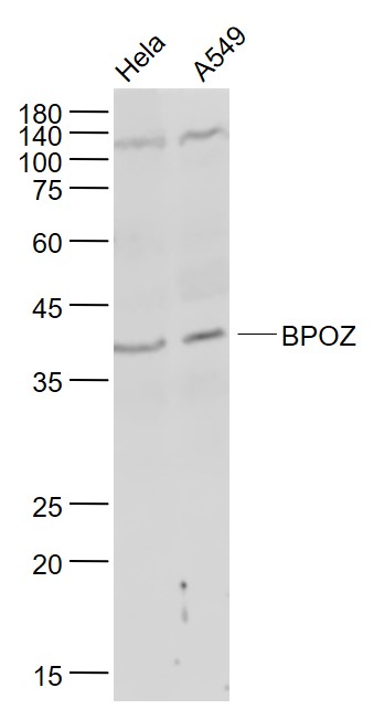 Lane 1: Hela cell lysates; Lane 2: A549 cell lysates probed with BPOZ/ABTB1 Polyclonal Antibody, Unconjugated (bs-12881R) at 1:1000 dilution and 4˚C overnight incubation. Followed by conjugated secondary antibody incubation at 1:20000 for 60 min at 37˚C.