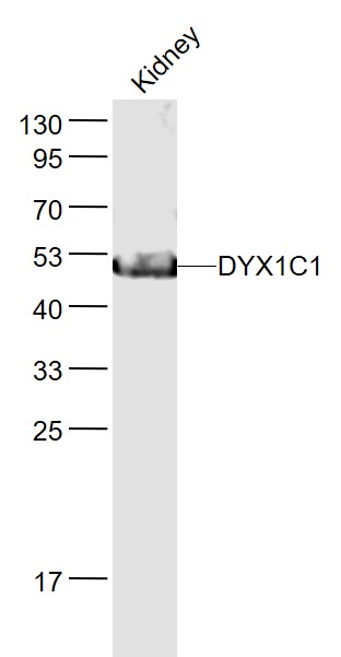 Lane 1: Mouse Kidney lysates probed with DYX1C1 Polyclonal Antibody, Unconjugated (bs-13043R) at 1:1000 dilution and 4˚C overnight incubation. Followed by conjugated secondary antibody incubation at 1:20000 for 60 min at 37˚C.
