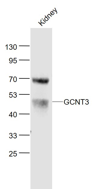 Lane 1: Mouse Kidney lysates probed with GCNT3 Polyclonal Antibody, Unconjugated (bs-13317R) at 1:1000 dilution and 4˚C overnight incubation. Followed by conjugated secondary antibody incubation at 1:20000 for 60 min at 37˚C.
