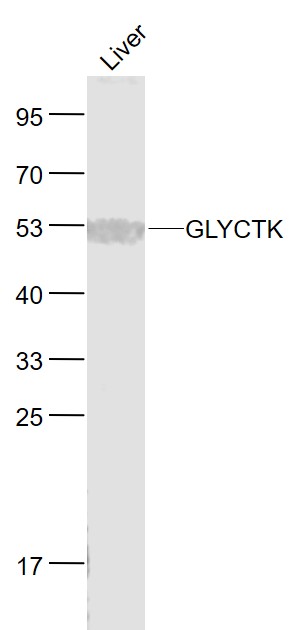Lane 1: Mouse Liver lysates probed with GLYCTK Polyclonal Antibody, Unconjugated (bs-13448R) at 1:1000 dilution and 4˚C overnight incubation. Followed by conjugated secondary antibody incubation at 1:20000 for 60 min at 37˚C.