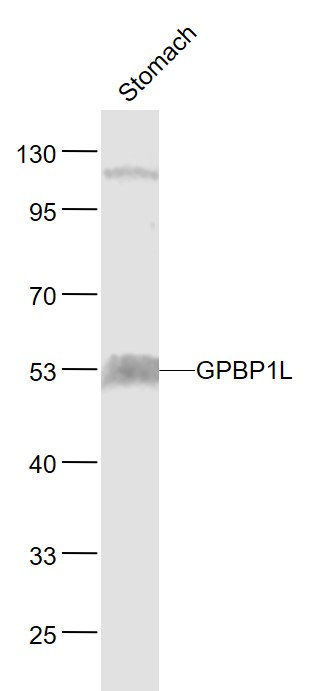 Lane 1: Mouse Stomach lysates probed with GPBP1L1 Polyclonal Antibody, Unconjugated (bs-13504R) at 1:1000 dilution and 4˚C overnight incubation. Followed by conjugated secondary antibody incubation at 1:20000 for 60 min at 37˚C.