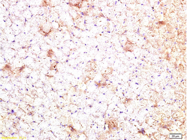 Formalin-fixed and paraffin embedded rat heart tissue labeled Anti-CTGF Polyclonal Antibody, Unconjugated (bs-0743R) at 1:200, followed by conjugation to the secondary antibody and DAB staining