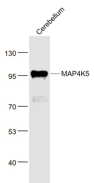 Lane 1: Mouse Cerebellum lysates probed with MAP4K5 Polyclonal Antibody, Unconjugated (bs-13654R) at 1:1000 dilution and 4˚C overnight incubation. Followed by conjugated secondary antibody incubation at 1:20000 for 60 min at 37˚C.