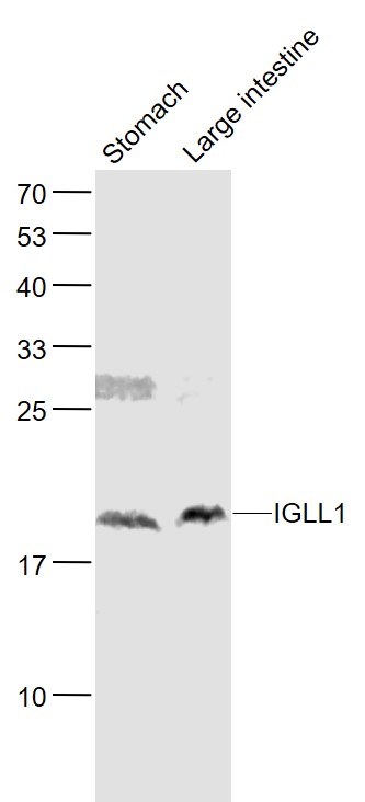 Lane 1: Mouse Stomach lysates; Lane 2: Mouse Large intestine lysates probed with IGLL1 Polyclonal Antibody, Unconjugated (bs-15577R) at 1:1000 dilution and 4˚C overnight incubation. Followed by conjugated secondary antibody incubation at 1:20000 for 60 min at 37˚C._x000D_