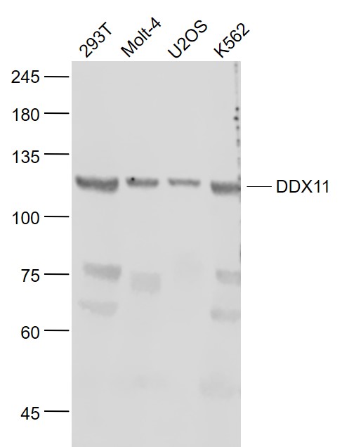 Lane 1: 293T cell lysates; Lane 2: Molt-4 cell lysates; Lane 3: U2os cell lysates; Lane 4:K562 cell lysates probed with KRG2/DDX11 Polyclonal Antibody, Unconjugated (bs-22217R) at 1:1000 dilution and 4˚C overnight incubation. Followed by conjugated secondary antibody incubation at 1:20000 for 60 min at 37˚C.