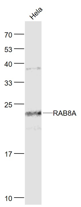 Lane 1: Hela cell lysates probed with RAB8A (8A4) Monoclonal Antibody, Unconjugated (bsm-51077M) at 1:1000 dilution and 4˚C overnight incubation. Followed by conjugated secondary antibody incubation at 1:20000 for 60 min at 37˚C.