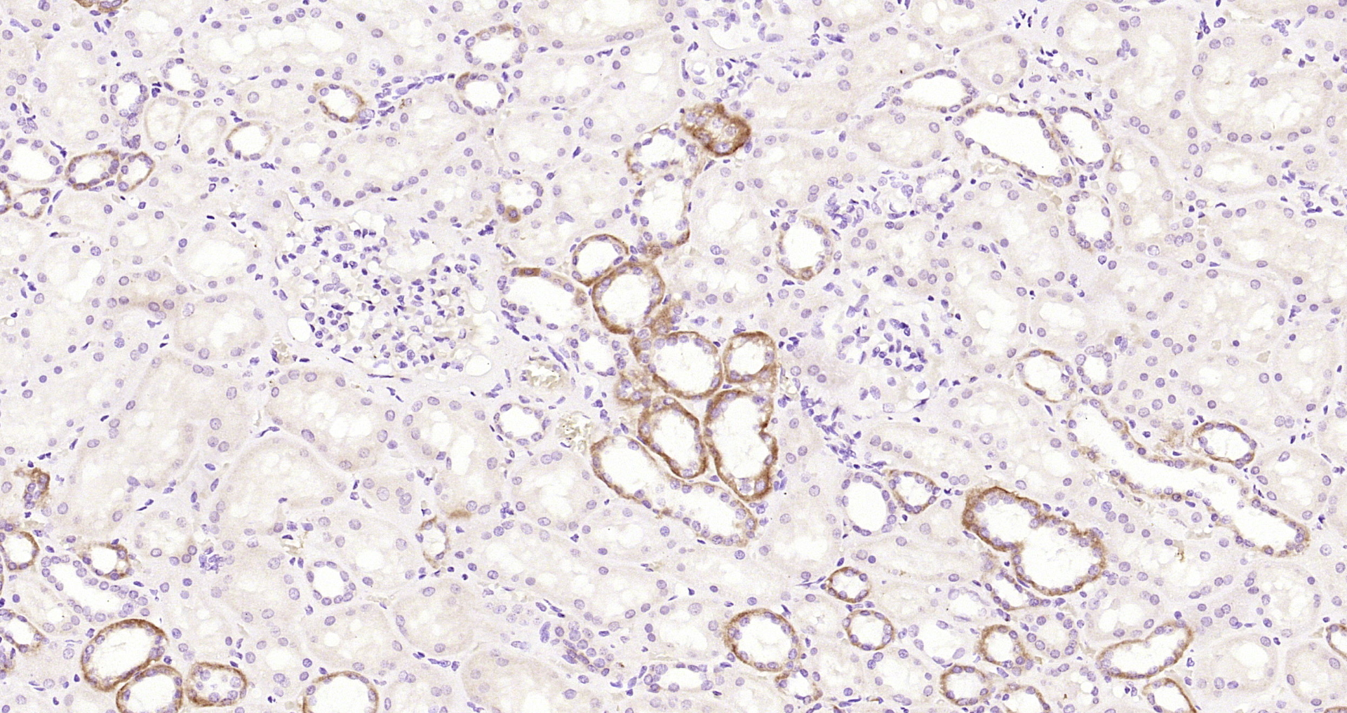 Paraformaldehyde-fixed, paraffin embedded Human kidney; Antigen retrieval by boiling in sodium citrate buffer (pH6.0) for 15min; Block endogenous peroxidase by 3% hydrogen peroxide for 20 minutes; Blocking buffer (normal goat serum) at 37°C for 30min; Antibody incubation with TSPAN32 Polyclonal Antibody, Unconjugated (bs-12531R) at 1:200 overnight at 4°C, DAB staining.