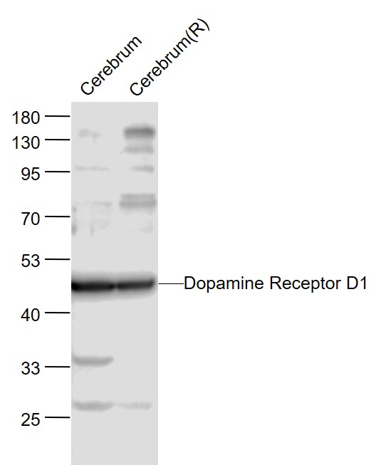 Lane 1: Mouse Cerebrum lysates; Lane 2: Rat Cerebrum lysates probed with DRD1 Polyclonal Antibody, Unconjugated (bs-1007R) at 1:1000 dilution and 4˚C overnight incubation. Followed by conjugated secondary antibody incubation at 1:20000 for 60 min at 37˚C.