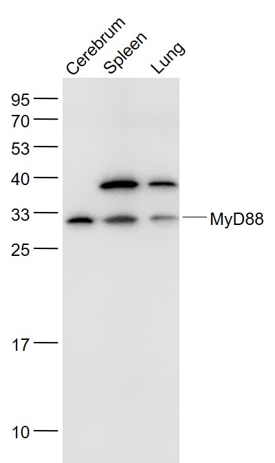 Lane 1: Mouse Cerebrum lysates; Lane 2: Mouse Spleen lysates; Lane 3: Mouse Lung lysates probed with MyD88 Polyclonal Antibody, Unconjugated (bs-1047R) at 1:1000 dilution and 4˚C overnight incubation. Followed by conjugated secondary antibody incubation at 1:20000 for 60 min at 37˚C.