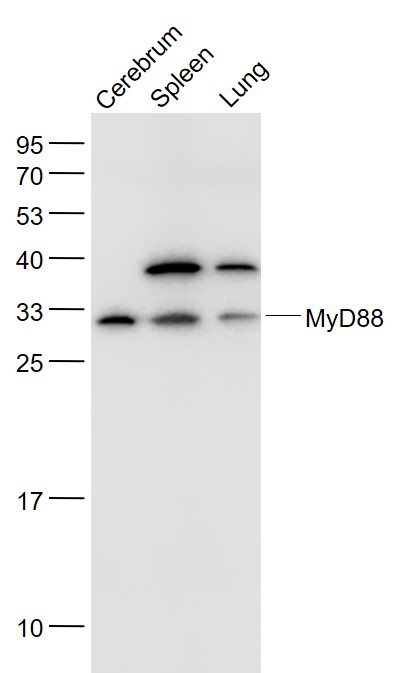 Lane 1: Mouse Cerebrum lysates; Lane 2: Mouse Spleen lysates; Lane 3: Mouse Lung lysates probed with MyD88 Polyclonal Antibody, Unconjugated (bs-1047R) at 1:1000 dilution and 4˚C overnight incubation. Followed by conjugated secondary antibody incubation at 1:20000 for 60 min at 37˚C. Lane 1: Mouse Cerebrum lysates; Lane 2: Mouse Spleen lysates; Lane 3: Mouse Lung lysates probed with MyD88 Polyclonal Antibody, Unconjugated (bs-1047R) at 1:1000 dilution and 4˚C overnight incubation. Followed by conjugated secondary antibody incubation at 1:20000 for 60 min at 37˚C.