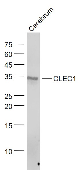 Lane 1: Mouse Cerebrum lysates probed with CLEC1/CLEC1A Polyclonal Antibody, Unconjugated (bs-2542R) at 1:1000 dilution and 4˚C overnight incubation. Followed by conjugated secondary antibody incubation at 1:20000 for 60 min at 37˚C.