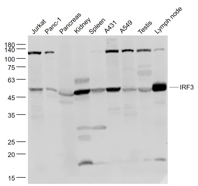 Lane 1: Jurkat cell lysates; Lane 2: Panc-1 cell lysates; Lane 3: Mouse Pancreas lysates; Lane 4: Mouse Kidney lysates ; Lane 5: Mouse Spleen lysates; Lane 6: A431 cell lysates; Lane 7: A549 cell lysates; Lane 8: Mouse Testis lysates; Lane 9: Mouse Lymph node lysates probed with IRF3 Polyclonal Antibody, Unconjugated (bs-2993R) at 1:1000 dilution and 4˚C overnight incubation. Followed by conjugated secondary antibody incubation at 1:20000 for 60 min at 37˚C.