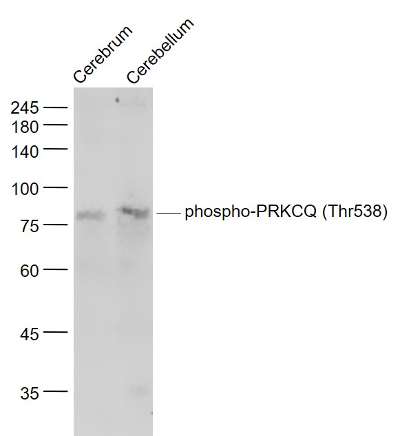 Lane 1: Mouse Cerebrum lysates; Lane 2: Mouse Cerebellum lysates probed with PRKCQ(Thr538) Polyclonal Antibody, Unconjugated (bs-5585R) at 1:1000 dilution and 4˚C overnight incubation. Followed by conjugated secondary antibody incubation at 1:20000 for 60 min at 37˚C.