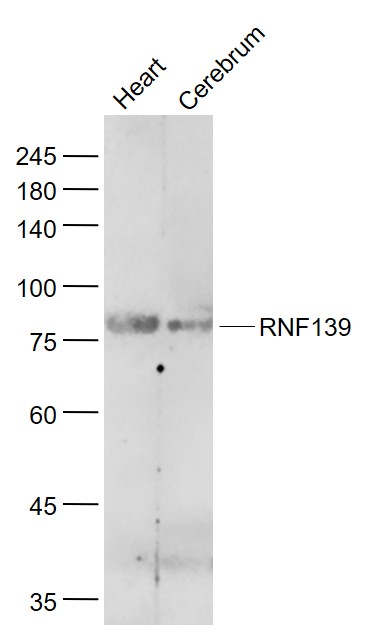 Lane 1: Mouse Heart lysates; Lane 2: Mouse Cerebrum lysates probed with RNF139 Polyclonal Antibody, Unconjugated (bs-6096R) at 1:1000 dilution and 4˚C overnight incubation. Followed by conjugated secondary antibody incubation at 1:20000 for 60 min at 37˚C.