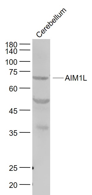 Lane 1: Mouse Cerebellum lysates probed with AIM1L Polyclonal Antibody, Unconjugated (bs-9093R) at 1:1000 dilution and 4˚C overnight incubation. Followed by conjugated secondary antibody incubation at 1:20000 for 60 min at 37˚C.