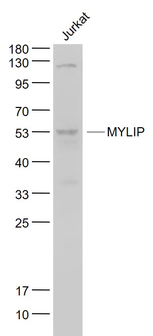 Lane 1: Jurkat cell lysates probed with MYLIP Polyclonal Antibody, Unconjugated (bs-9674R) at 1:1000 dilution and 4˚C overnight incubation. Followed by conjugated secondary antibody incubation at 1:20000 for 60 min at 37˚C.