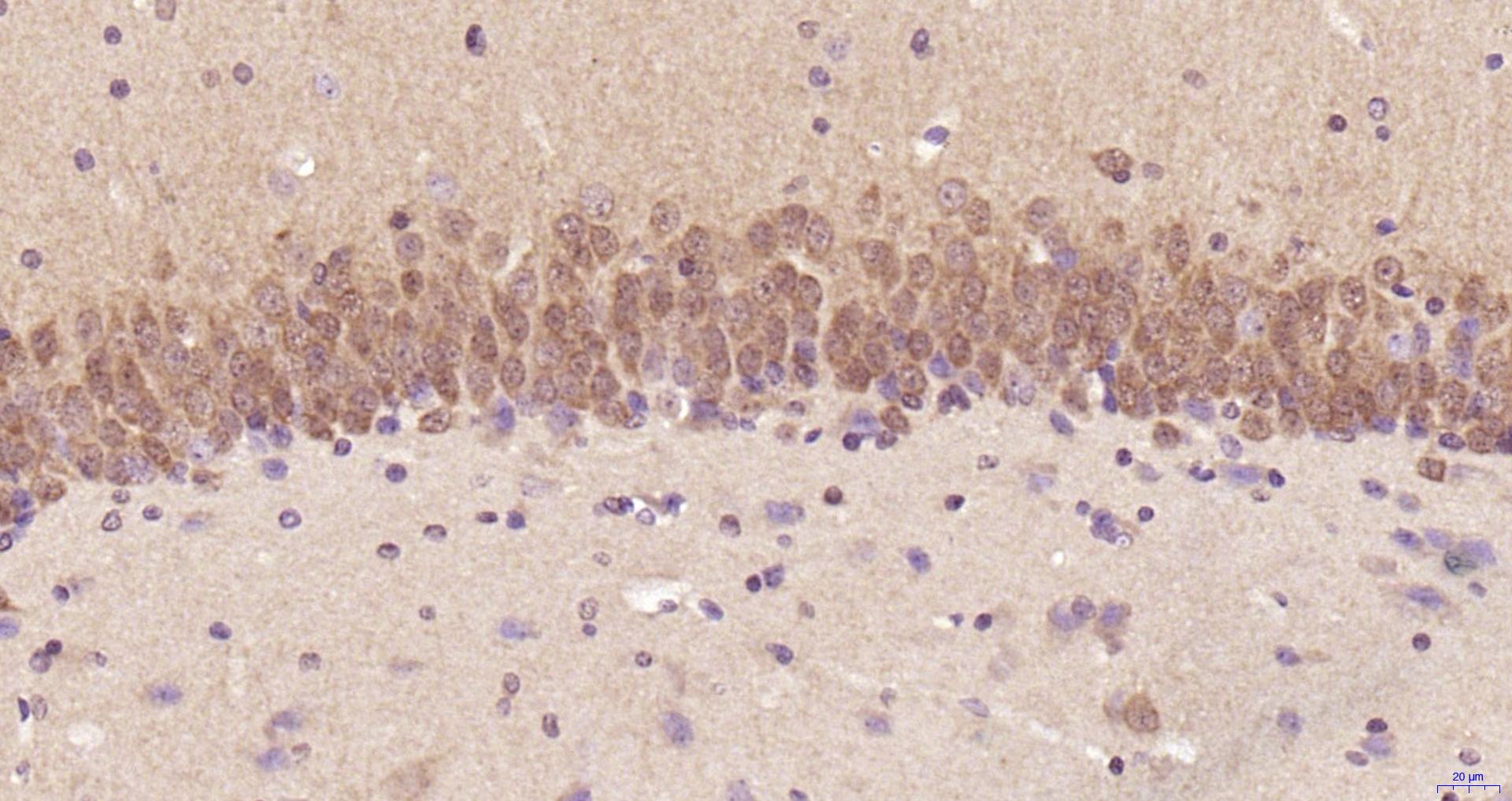 Paraformaldehyde-fixed, paraffin embedded Rat brain; Antigen retrieval by boiling in sodium citrate buffer (pH6.0) for 15min; Block endogenous peroxidase by 3% hydrogen peroxide for 20 minutes; Blocking buffer (normal goat serum) at 37°C for 30min; Antibody incubation with ERK1/2 Monoclonal Antibody, Unconjugated (bsm-33232M) at 1:200 overnight at 4°C, DAB staining.