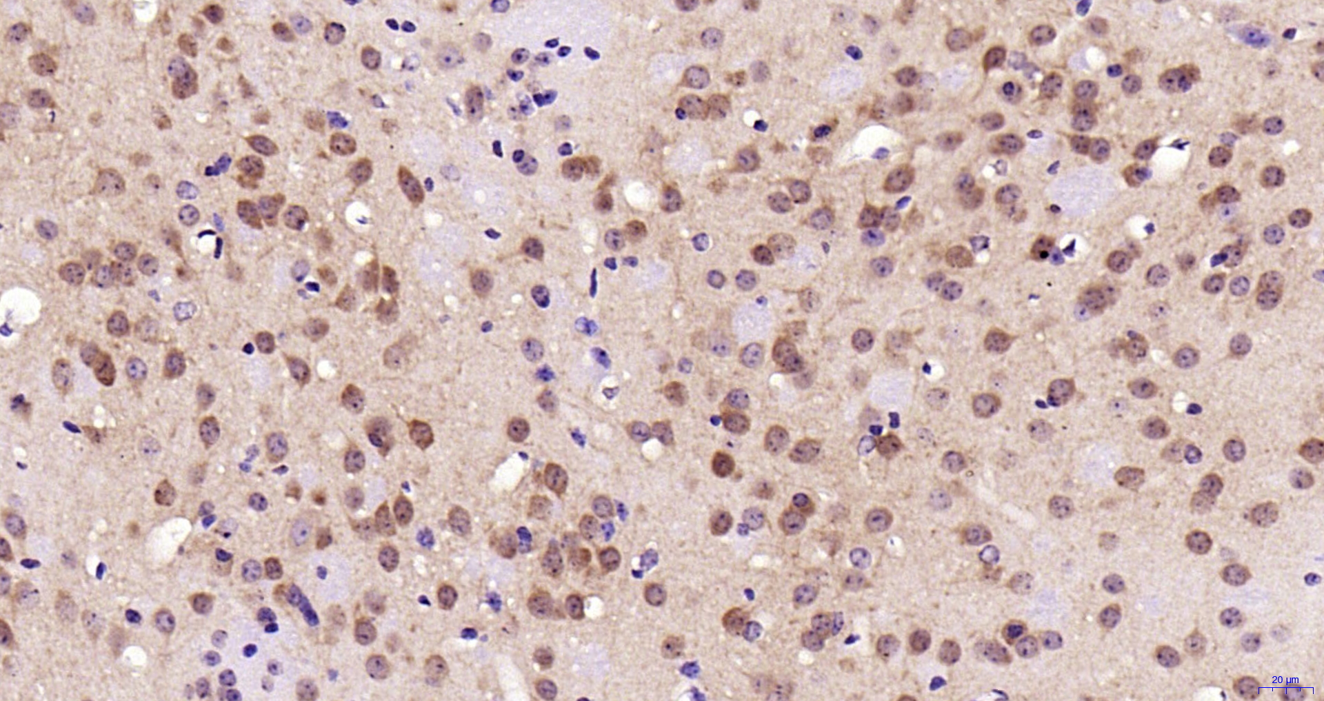 Paraformaldehyde-fixed, paraffin embedded Mouse brain; Antigen retrieval by boiling in sodium citrate buffer (pH6.0) for 15min; Block endogenous peroxidase by 3% hydrogen peroxide for 20 minutes; Blocking buffer (normal goat serum) at 37°C for 30min; Antibody incubation with ERK1/2 Monoclonal Antibody, Unconjugated (bsm-33232M) at 1:200 overnight at 4°C, DAB staining.