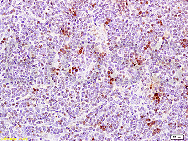 Formalin-fixed and paraffin embedded rat thymus tissue labeled Anti-PCNA Polyclonal Antibody, Unconjugated (bs-0754R) at 1:200, followed by conjugation to the secondary antibody and DAB staining