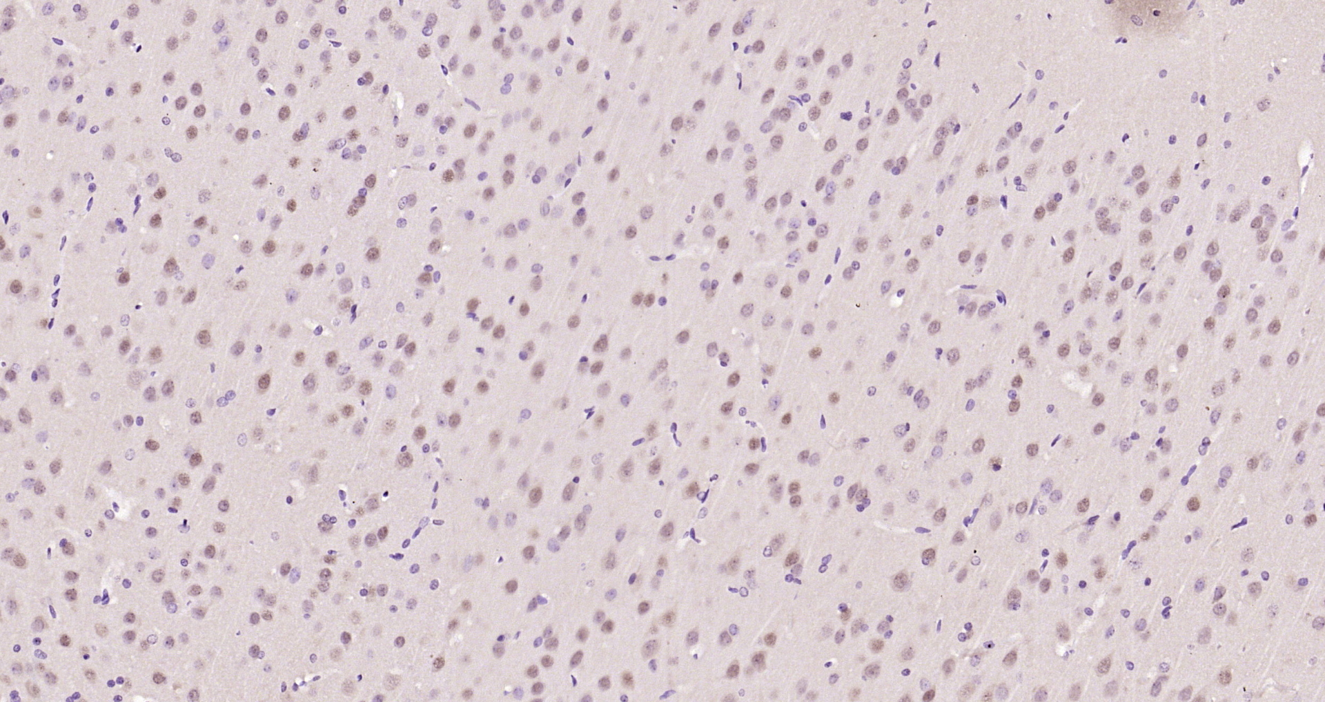 Paraformaldehyde-fixed, paraffin embedded Rat brain; Antigen retrieval by boiling in sodium citrate buffer (pH6.0) for 15min; Block endogenous peroxidase by 3% hydrogen peroxide for 20 minutes; Blocking buffer (normal goat serum) at 37°C for 30min; Antibody incubation with ATF6 Polyclonal Antibody, Unconjugated (bs-1634R) at 1:200 overnight at 4°C, DAB staining.
