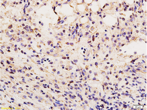 Formalin-fixed and paraffin embedded mouse kidney tissue labeled Anti-Vimentin Polyclonal Antibody, Unconjugated (bs-0756R) at 1:200, followed by conjugation to the secondary antibody and DAB staining