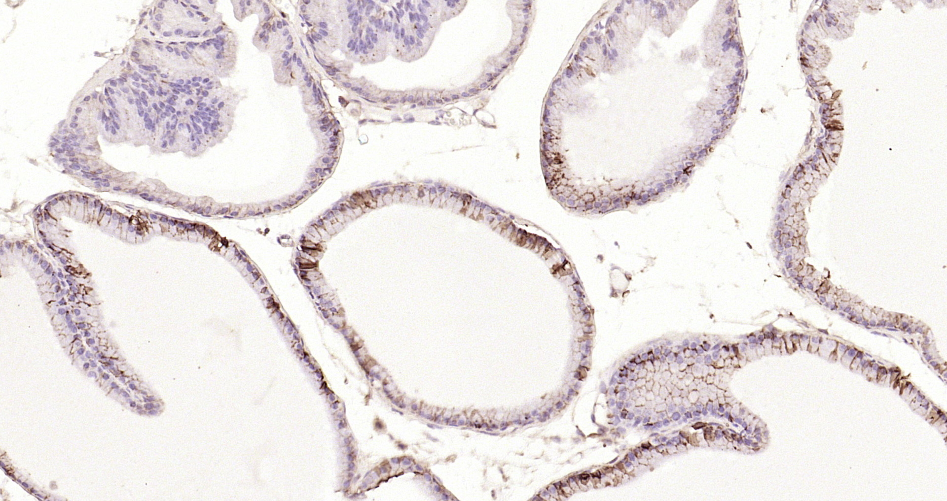 Paraformaldehyde-fixed, paraffin embedded Mouse thyroid; Antigen retrieval by boiling in sodium citrate buffer (pH6.0) for 15min; Block endogenous peroxidase by 3% hydrogen peroxide for 20 minutes; Blocking buffer (normal goat serum) at 37°C for 30min; Antibody incubation with Sodium Potassium ATPase (13H5) Monoclonal Antibody, Unconjugated (bsm-52485R) at 1:200 overnight at 4°C, DAB staining.