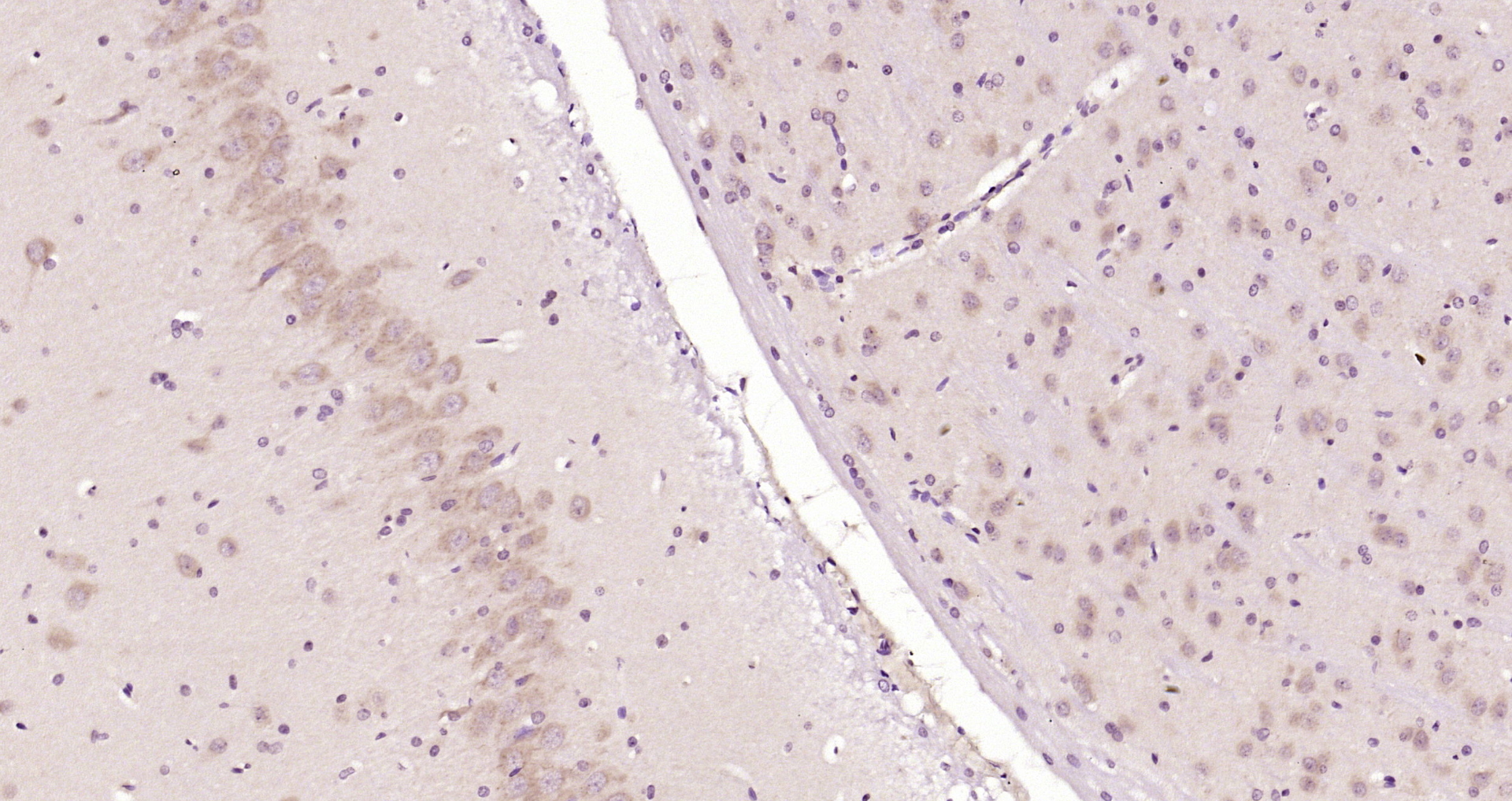 Paraformaldehyde-fixed, paraffin embedded Rat brain; Antigen retrieval by boiling in sodium citrate buffer (pH6.0) for 15min; Block endogenous peroxidase by 3% hydrogen peroxide for 20 minutes; Blocking buffer (normal goat serum) at 37°C for 30min; Antibody incubation with LAMP2 Polyclonal Antibody, Unconjugated (bs-2379R) at 1:200 overnight at 4°C, DAB staining.