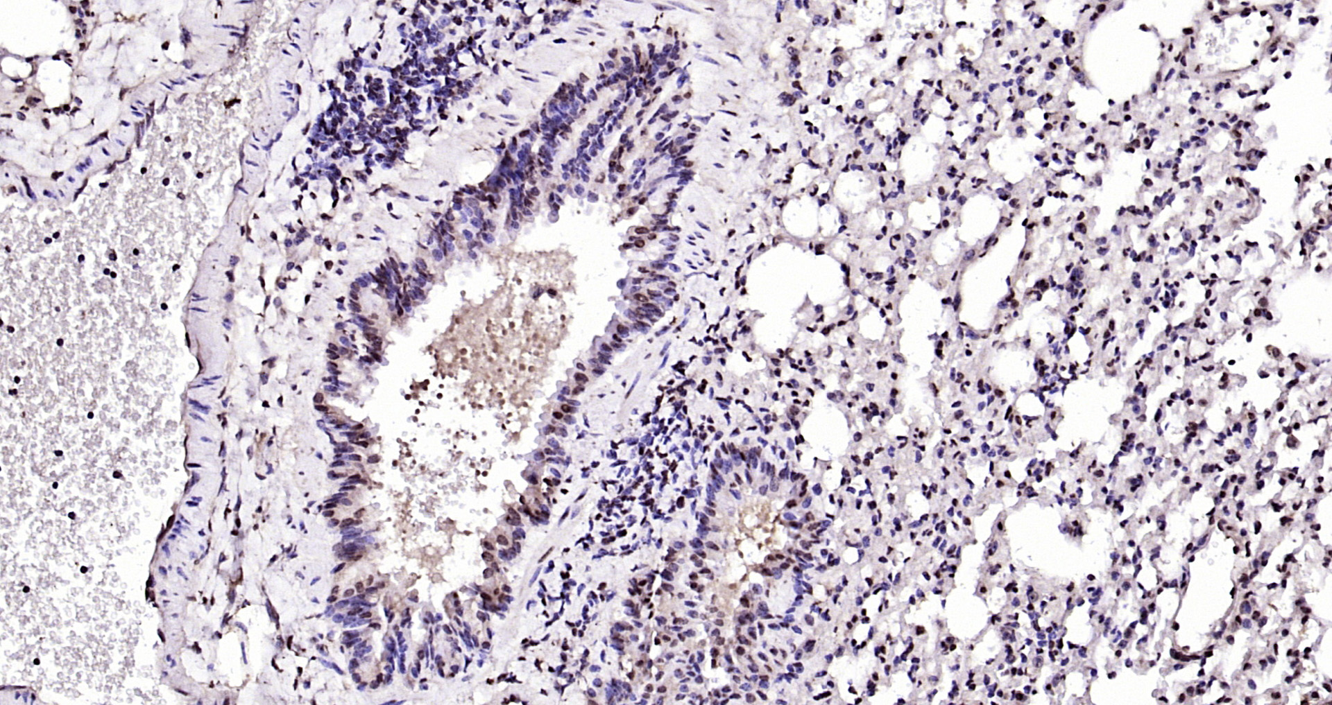 Paraformaldehyde-fixed, paraffin embedded Mouse lung; Antigen retrieval by boiling in sodium citrate buffer (pH6.0) for 15min; Block endogenous peroxidase by 3% hydrogen peroxide for 20 minutes; Blocking buffer (normal goat serum) at 37°C for 30min; Antibody incubation with BTG3 Polyclonal Antibody, Unconjugated (bs-7698R) at 1:200 overnight at 4°C, DAB staining.