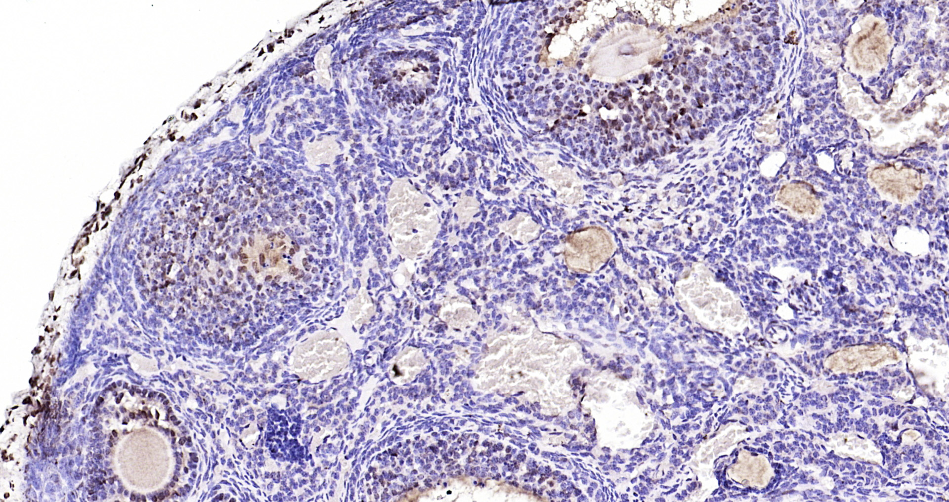 Paraformaldehyde-fixed, paraffin embedded Mouse ovarian; Antigen retrieval by boiling in sodium citrate buffer (pH6.0) for 15min; Block endogenous peroxidase by 3% hydrogen peroxide for 20 minutes; Blocking buffer (normal goat serum) at 37°C for 30min; Antibody incubation with BTG3 Polyclonal Antibody, Unconjugated (bs-7698R) at 1:200 overnight at 4°C, DAB staining.
