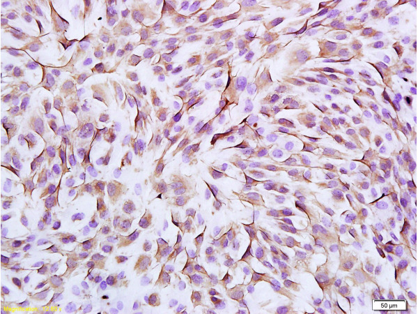 Formalin-fixed and paraffin embedded mouse mesenchymal stem cells labeled Anti-Vimentin Polyclonal Antibody, Unconjugated (bs-0756R) at 1:300, followed by conjugation to the secondary antibody and DAB staining