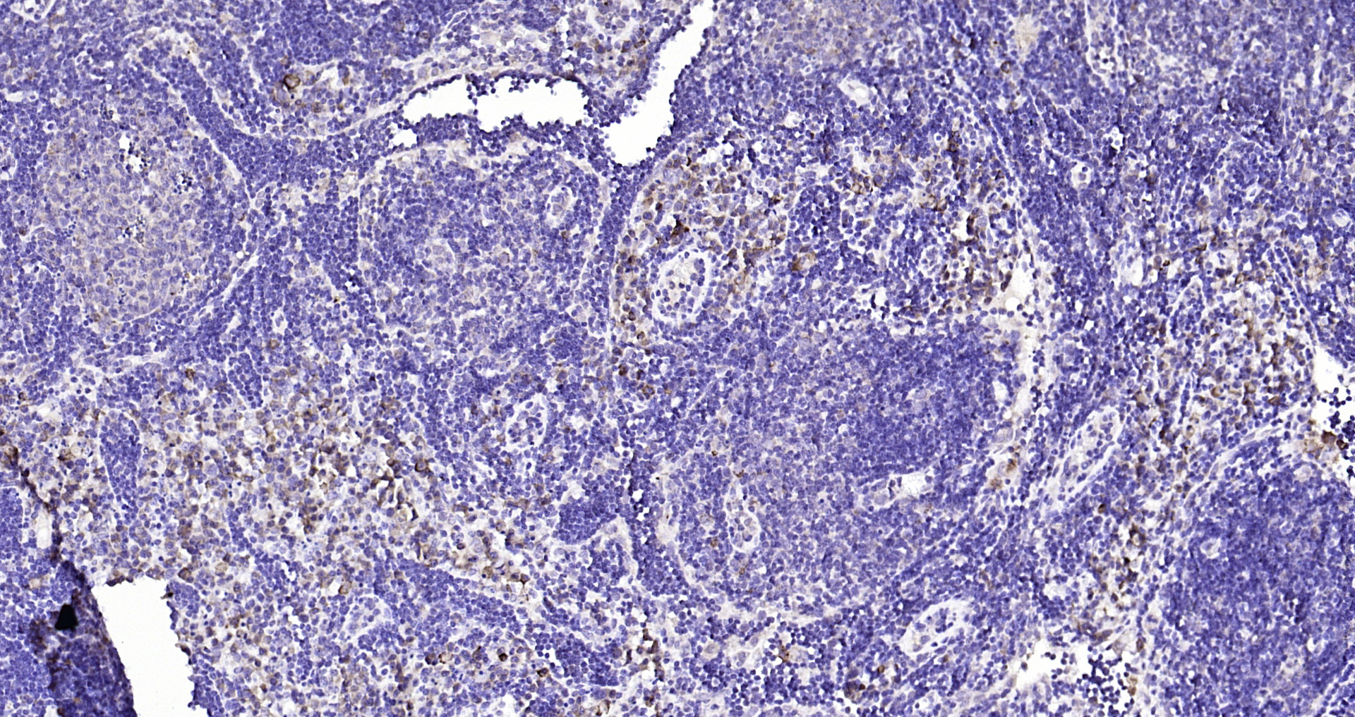Paraformaldehyde-fixed, paraffin embedded Mouse lymph node; Antigen retrieval by boiling in sodium citrate buffer (pH6.0) for 15min; Block endogenous peroxidase by 3% hydrogen peroxide for 20 minutes; Blocking buffer (normal goat serum) at 37°C for 30min; Antibody incubation with DTX3L Polyclonal Antibody, Unconjugated (bs-14438R) at 1:200 overnight at 4°C, DAB staining.