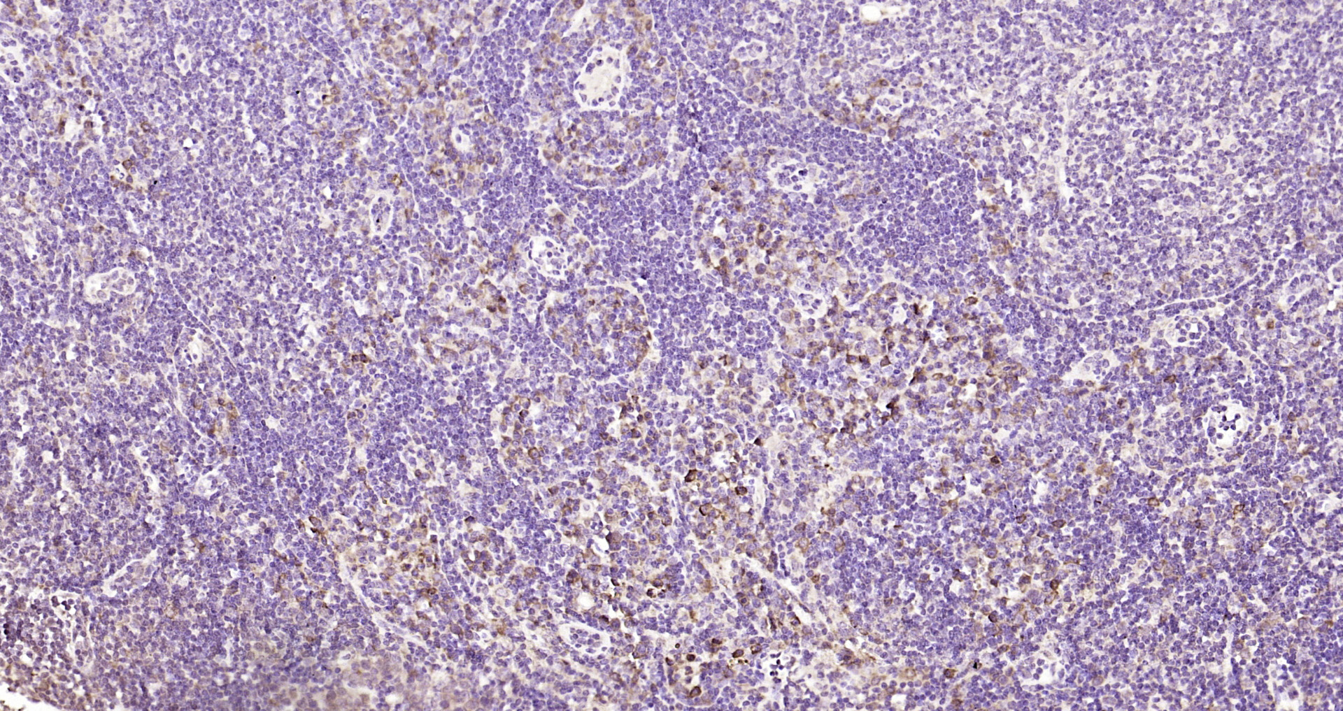 Paraformaldehyde-fixed, paraffin embedded Rat lymph node; Antigen retrieval by boiling in sodium citrate buffer (pH6.0) for 15min; Block endogenous peroxidase by 3% hydrogen peroxide for 20 minutes; Blocking buffer (normal goat serum) at 37°C for 30min; Antibody incubation with DTX3L Polyclonal Antibody, Unconjugated (bs-14438R) at 1:200 overnight at 4°C, DAB staining.