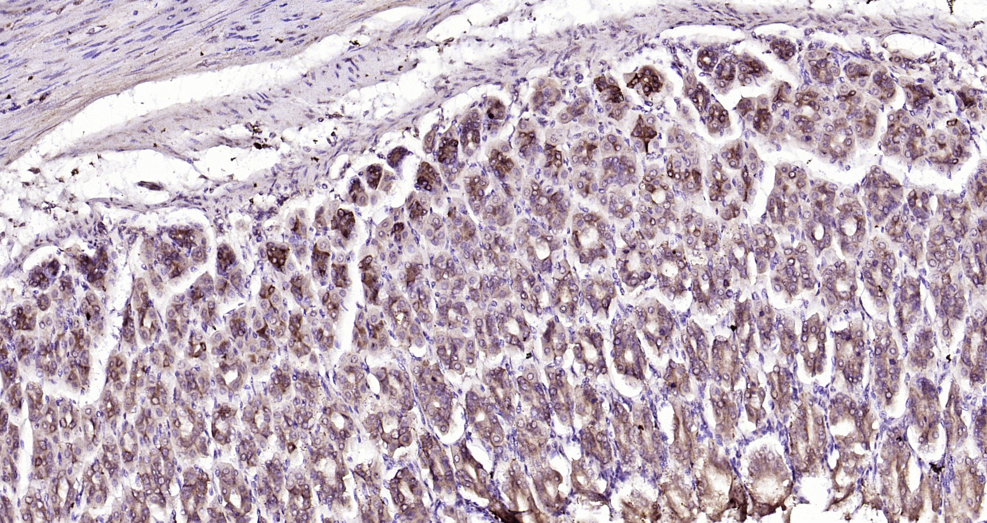 Paraformaldehyde-fixed, paraffin embedded Rat stomach; Antigen retrieval by boiling in sodium citrate buffer (pH6.0) for 15min; Block endogenous peroxidase by 3% hydrogen peroxide for 20 minutes; Blocking buffer (normal goat serum) at 37°C for 30min; Antibody incubation with DTX3L Polyclonal Antibody, Unconjugated (bs-14438R) at 1:200 overnight at 4°C, DAB staining.