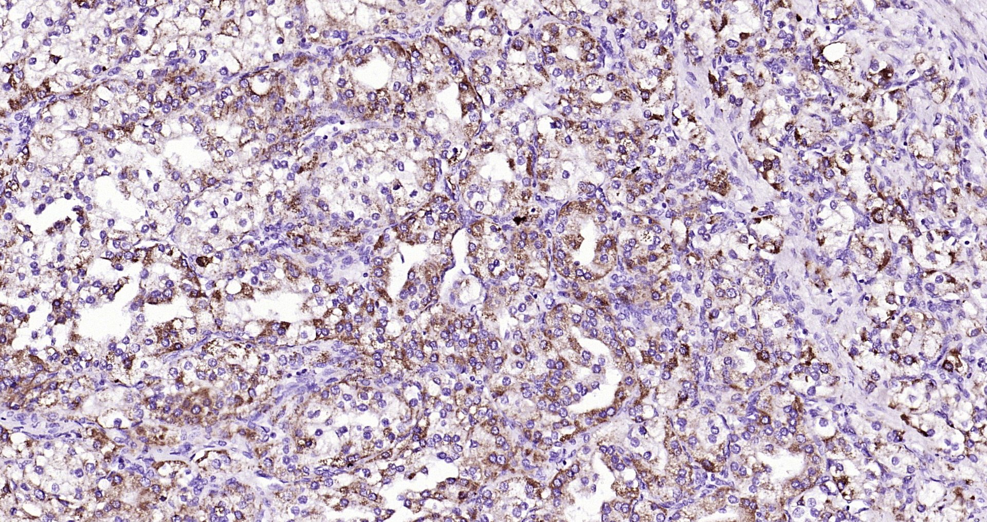 Paraformaldehyde-fixed, paraffin embedded Human kidney; Antigen retrieval by boiling in sodium citrate buffer (pH6.0) for 15min; Block endogenous peroxidase by 3% hydrogen peroxide for 20 minutes; Blocking buffer (normal goat serum) at 37°C for 30min; Antibody incubation with DTX3L Polyclonal Antibody, Unconjugated (bs-14438R) at 1:200 overnight at 4°C, DAB staining.