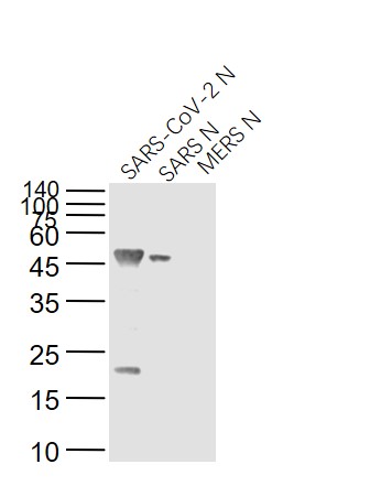 Lane 1: SARS-CoV-2 N Protein; Lane 2: Recombinant SARS N (1-422) protein; Lane 3: MERS N protein probed with SARS Nucleocapsid Protein (8G8A) Monoclonal Antibody, Unconjugated (bsm-49131M) at 1:1000 dilution and 4˚C overnight incubation. Followed by conjugated secondary antibody incubation at 1:20000 for 60 min at 37˚C.