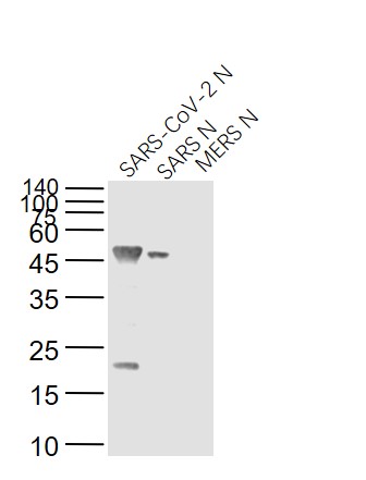 Lane 1: SARS-CoV-2 N Protein; Lane 2: Recombinant SARS N (1-422) protein; Lane 3: MERS N protein probed with SARS Nucleocapsid Protein (8G8A) Monoclonal Antibody, Unconjugated (bsm-49131M) at 1:1000 dilution and 4˚C overnight incubation. Followed by conjugated secondary antibody incubation at 1:20000 for 60 min at 37˚C. Lane 1: SARS-CoV-2 N Protein; Lane 2: Recombinant SARS N (1-422) protein; Lane 3: MERS N protein probed with SARS Nucleocapsid Protein (8G8A) Monoclonal Antibody, Unconjugated (bsm-49131M) at 1:1000 dilution and 4˚C overnight incubation. Followed by conjugated secondary antibody incubation at 1:20000 for 60 min at 37˚C.
