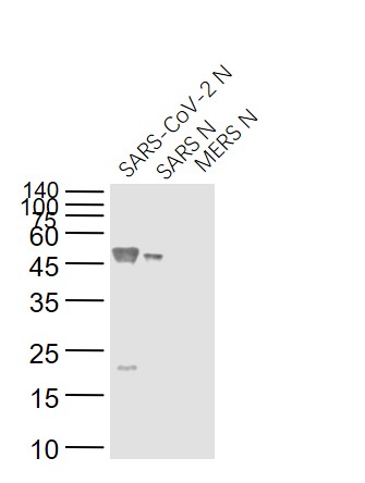 Lane 1: SARS-CoV-2 N Protein; Lane 2: Recombinant SARS N (1-422) protein; Lane 3: MERS N protein probed with SARS Nucleocapsid Protein (5B1B) Monoclonal Antibody, Unconjugated (bsm-49132M) at 1:1000 dilution and 4˚C overnight incubation. Followed by conjugated secondary antibody incubation at 1:20000 for 60 min at 37˚C.