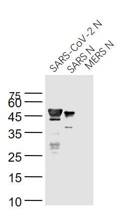 Lane 1: SARS-CoV-2 N Protein; Lane 2: Recombinant SARS N (1-422) protein; Lane 3: MERS N protein probed with SARS Nucleocapsid Protein (5C6C) Monoclonal Antibody, Unconjugated (bsm-49133M) at 1:1000 dilution and 4˚C overnight incubation. Followed by conjugated secondary antibody incubation at 1:20000 for 60 min at 37˚C.