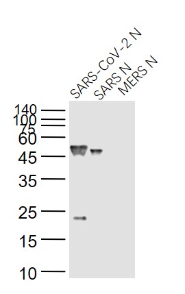 Lane 1: SARS-CoV-2 N Protein; Lane 2: Recombinant SARS N (1-422) protein; Lane 3: MERS N protein probed with SARS Nucleocapsid Protein (14B3D) Monoclonal Antibody, Unconjugated (bsm-49134M) at 1:1000 dilution and 4˚C overnight incubation. Followed by conjugated secondary antibody incubation at 1:20000 for 60 min at 37˚C.