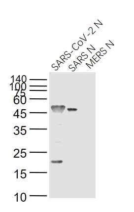 Lane 1: SARS-CoV-2 N Protein; Lane 2: Recombinant SARS N (1-422) protein; Lane 3: MERS N protein probed with SARS Nucleocapsid Protein (7C2B) Monoclonal Antibody, Unconjugated (bsm-49135M) at 1:1000 dilution and 4˚C overnight incubation. Followed by conjugated secondary antibody incubation at 1:20000 for 60 min at 37˚C.