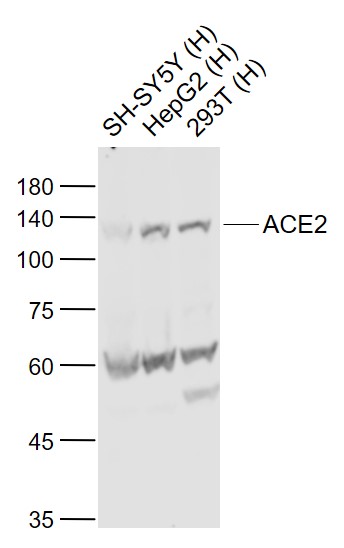 Lane 1: SH-SY5Y cell lysates; Lane 2: HepG2 cell lysates; Lane 3: 293T cell lysates probed with ACE2 Polyclonal Antibody, Unconjugated (bs-23444R) at 1:1000 dilution and 4˚C overnight incubation. Followed by conjugated secondary antibody incubation at 1:20000 for 60 min at 37˚C.