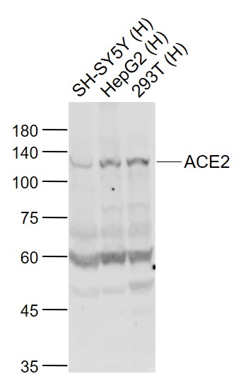 Lane 1: SH-SY5Y cell lysates; Lane 2: HepG2 cell lysates; Lane 3: 293T cell lysates probed with ACE2 Polyclonal Antibody, Unconjugated (bs-23443R) at 1:1000 dilution and 4˚C overnight incubation. Followed by conjugated secondary antibody incubation at 1:20000 for 60 min at 37˚C.