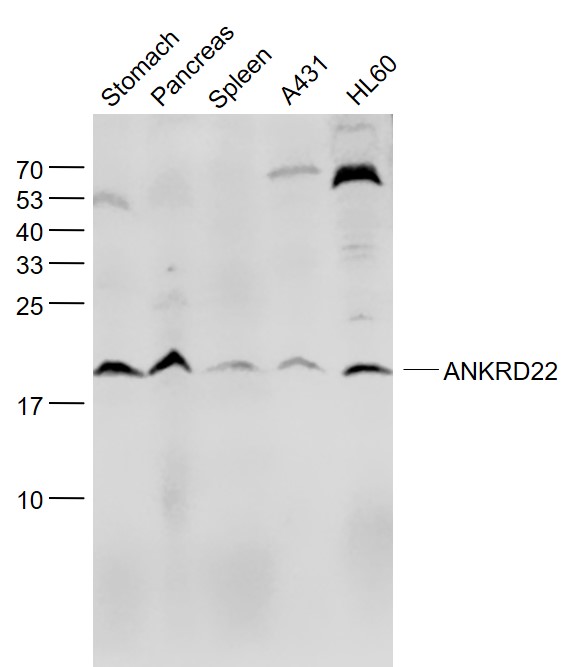 Lane 1: Mouse Stomach lysates; Lane 2: Mouse Placenta lysates; Lane 3: Mouse Spleen lysates; Lane 4: A431 cell lysates ; Lane 5: HL60 cell lysates probed with ANKRD22 Polyclonal Antibody, Unconjugated (bs-9748R) at 1:1000 dilution and 4˚C overnight incubation. Followed by conjugated secondary antibody incubation at 1:20000 for 60 min at 37˚C.