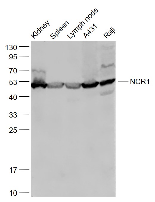 Lane 1: Mouse Kidney lysates; Lane 2: Mouse Spleen lysates; Lane 3: Mouse Lymph node lysates; Lane 4: A431 cell lysates ; Lane 5: Raji cell lysates probed with NCR1 Polyclonal Antibody, Unconjugated (bs-10027R) at 1:1000 dilution and 4˚C overnight incubation. Followed by conjugated secondary antibody incubation at 1:20000 for 60 min at 37˚C.