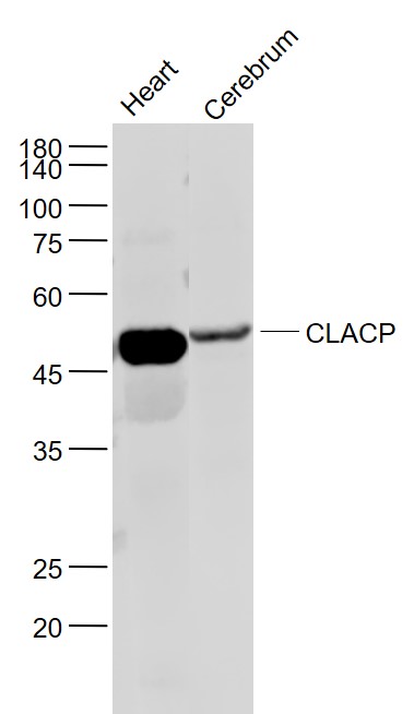 Lane 1: Mouse Heart lysates; Lane 2: Mouse Cerebrum lysates probed with CLACP/COL25A1 Polyclonal Antibody, Unconjugated (bs-11643R) at 1:1000 dilution and 4˚C overnight incubation. Followed by conjugated secondary antibody incubation at 1:20000 for 60 min at 37˚C.