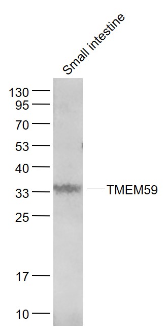 Lane 1: Mouse Small intestine lysates probed with TMEM59 Polyclonal Antibody, Unconjugated (bs-11647R) at 1:1000 dilution and 4˚C overnight incubation. Followed by conjugated secondary antibody incubation at 1:20000 for 60 min at 37˚C.