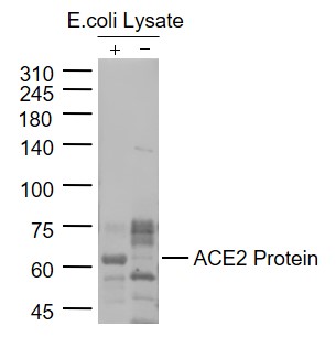 Lane 1: ACE2 Protein Overexpression E.coli lysates; Lane 2: Control group E.coli Lysates probed with ACE2 Polyclonal Antibody, Unconjugated (bs-23027R) at 1:1000 dilution and 4˚C overnight incubation. Followed by conjugated secondary antibody incubation at 1:20000 for 60 min at 37˚C.