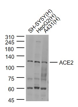 Lane 1: SH-SY5Y cell lysates; Lane 2: HepG2 cell lysates; Lane 3: A431 cell lysates probed with ACE2 Polyclonal Antibody, Unconjugated (bs-23443R) at 1:1000 dilution and 4˚C overnight incubation. Followed by conjugated secondary antibody incubation at 1:20000 for 60 min at 37˚C.